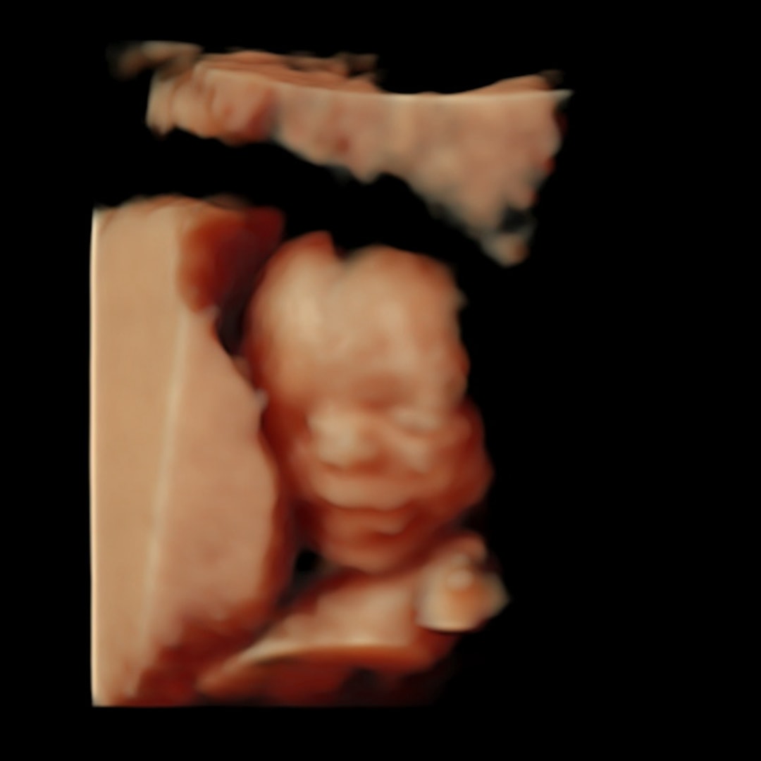 Photo shared by Ellie for their Babylist baby registry.