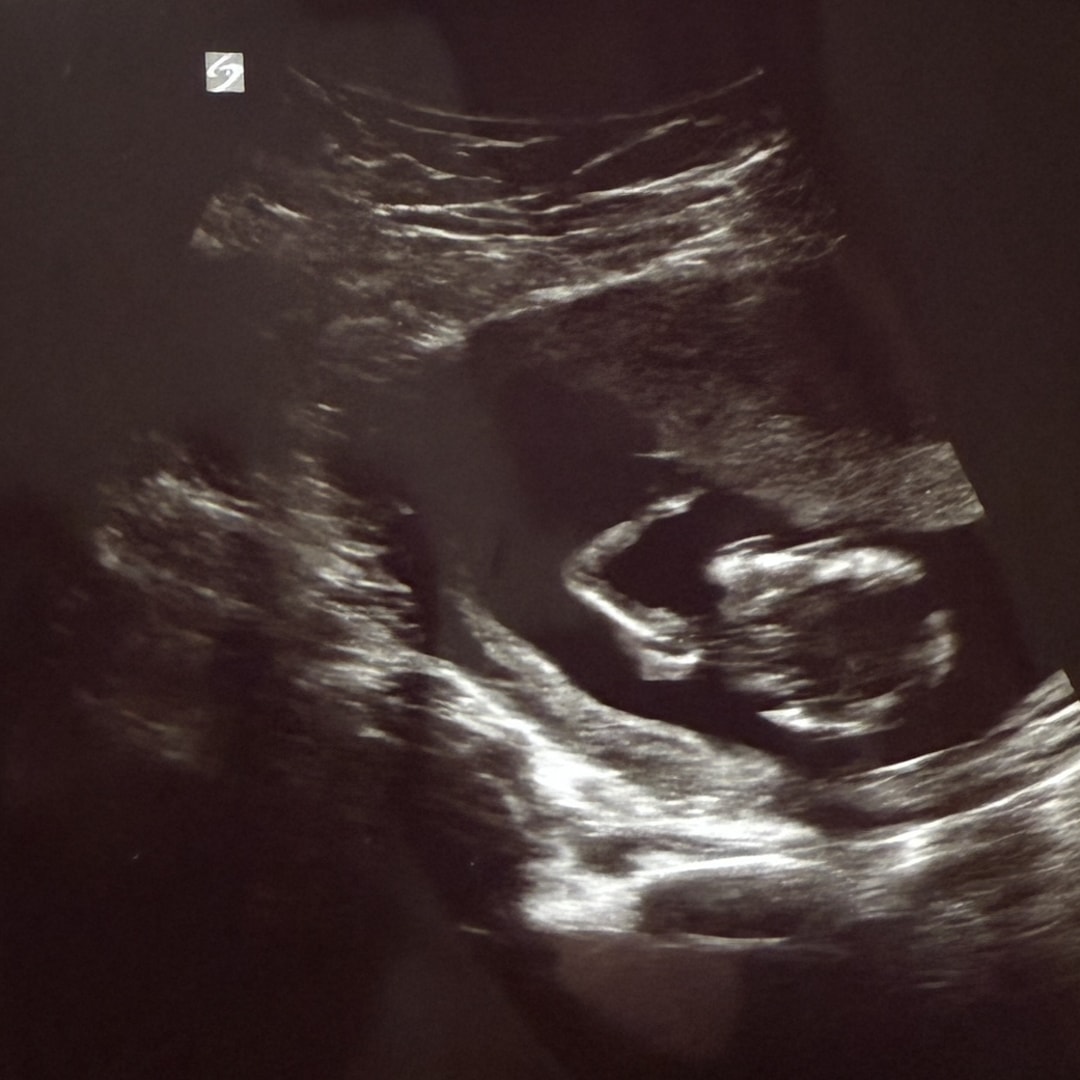 Photo shared by Abbie for their Babylist baby registry.