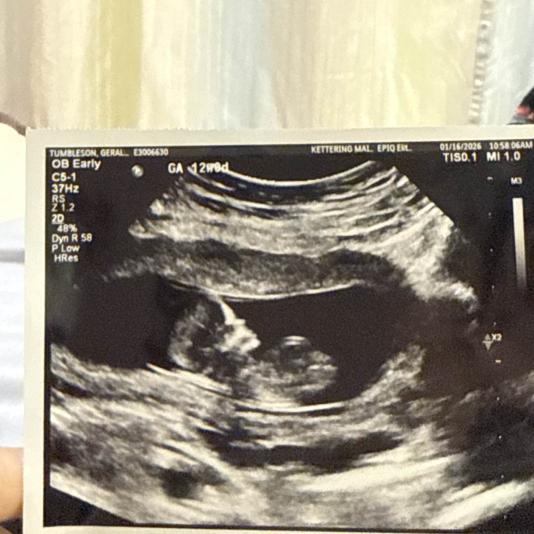 Photo shared by Din for their Babylist baby registry.