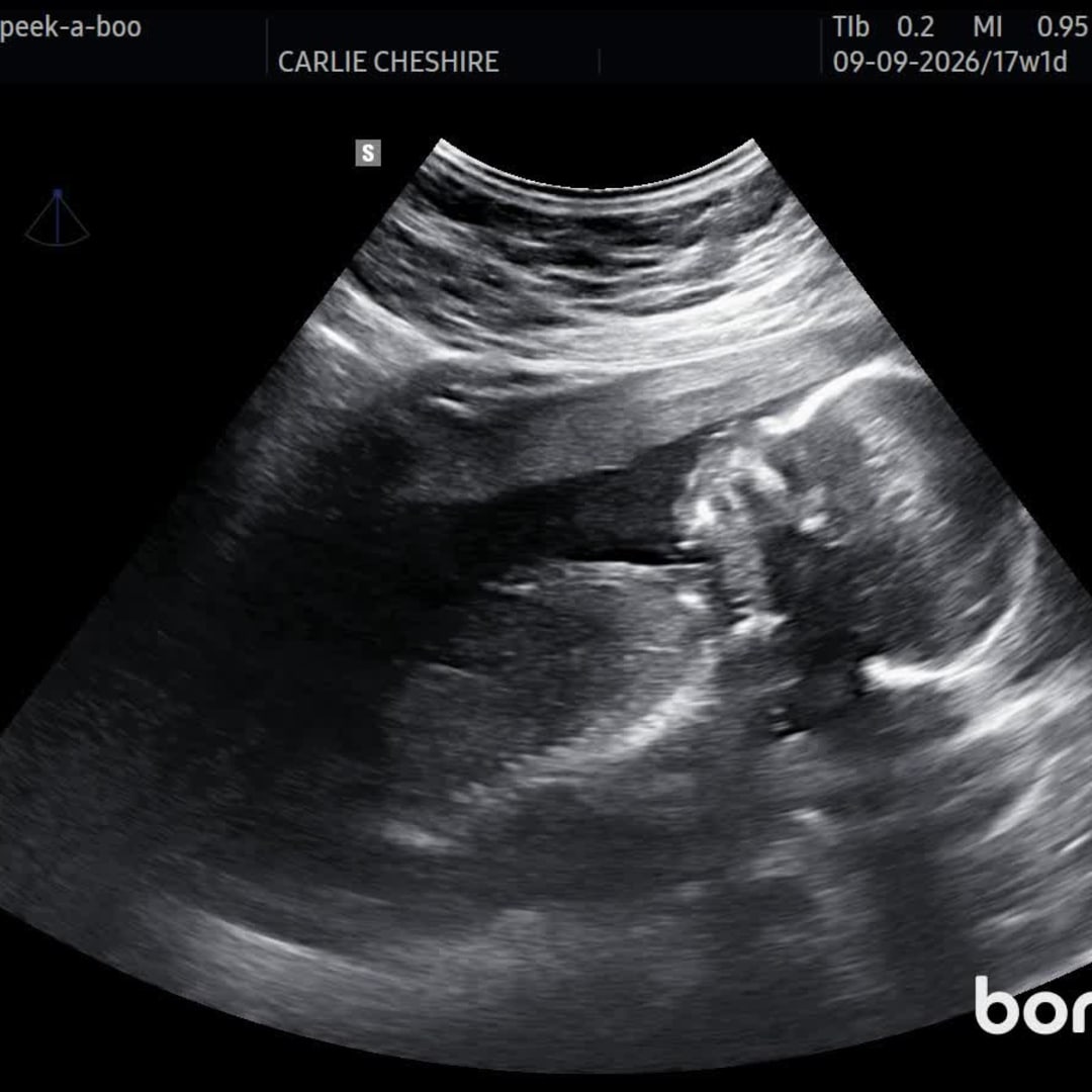 Photo shared by Carlie for their Babylist baby registry.
