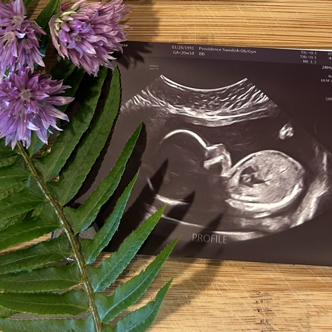 Photo shared by Anna for their Babylist baby registry.