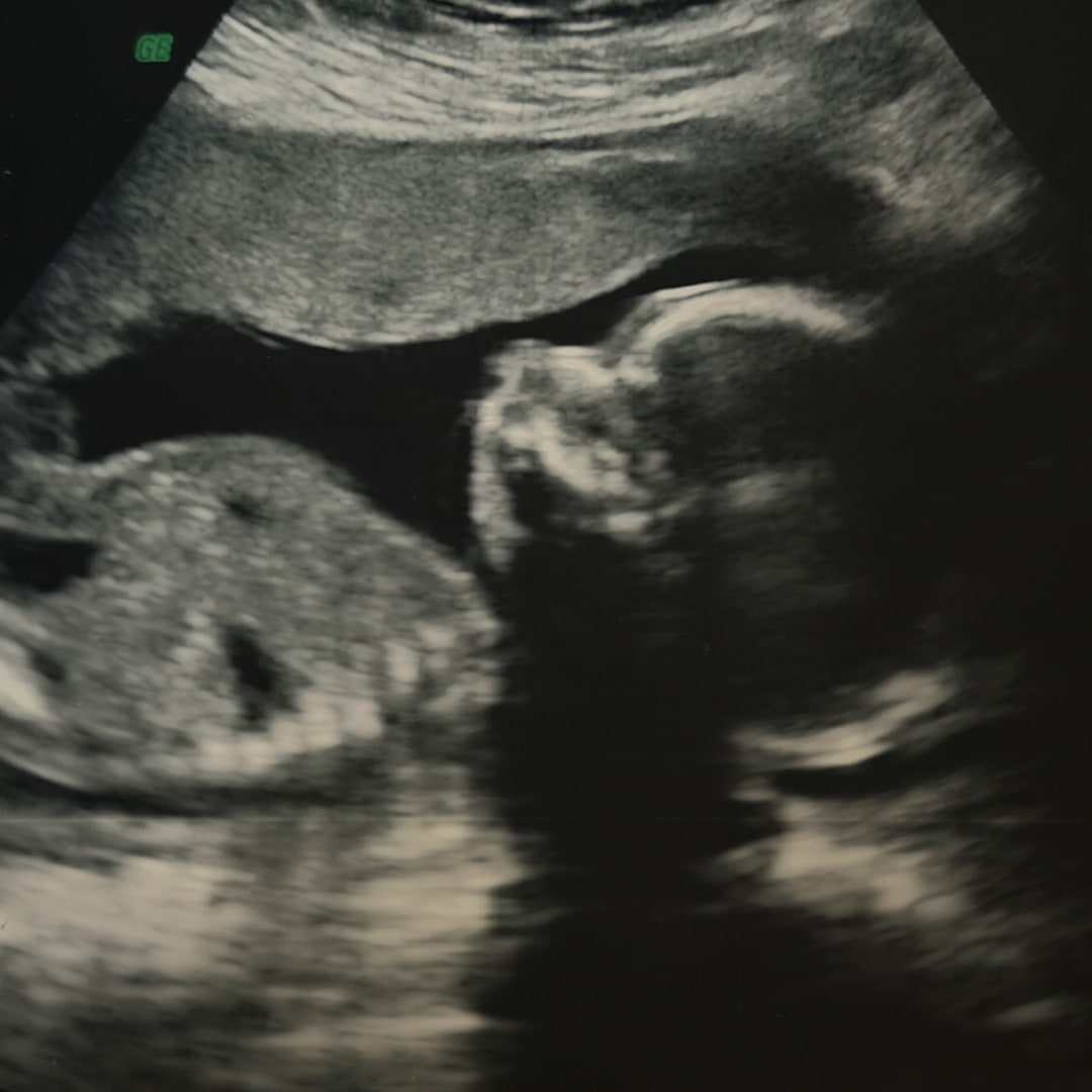 Photo shared by Tatum for their Babylist baby registry.