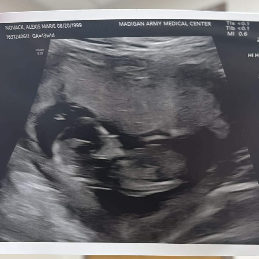 Photo shared by Alexis for their Babylist baby registry.