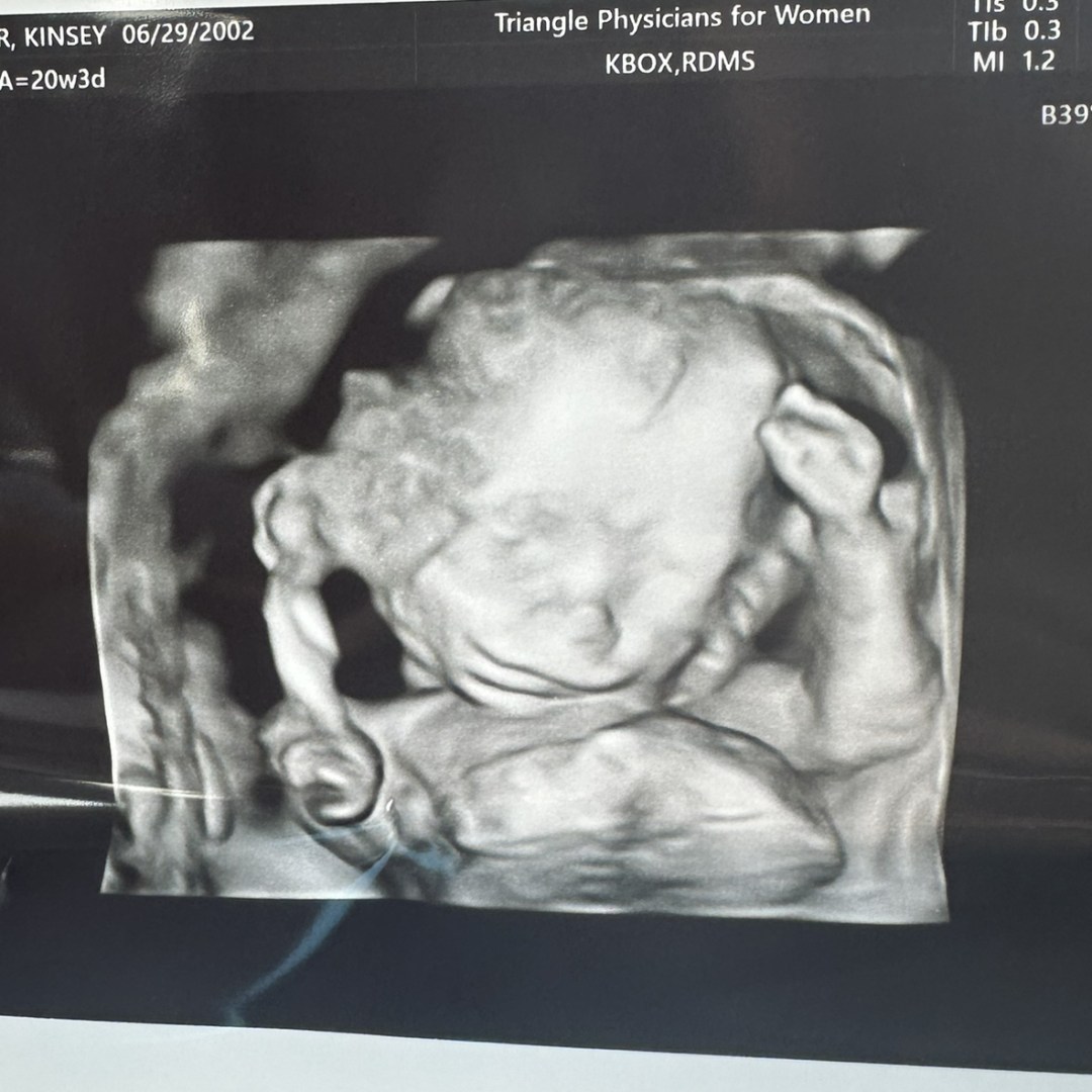 Photo shared by Kinsey for their Babylist baby registry.