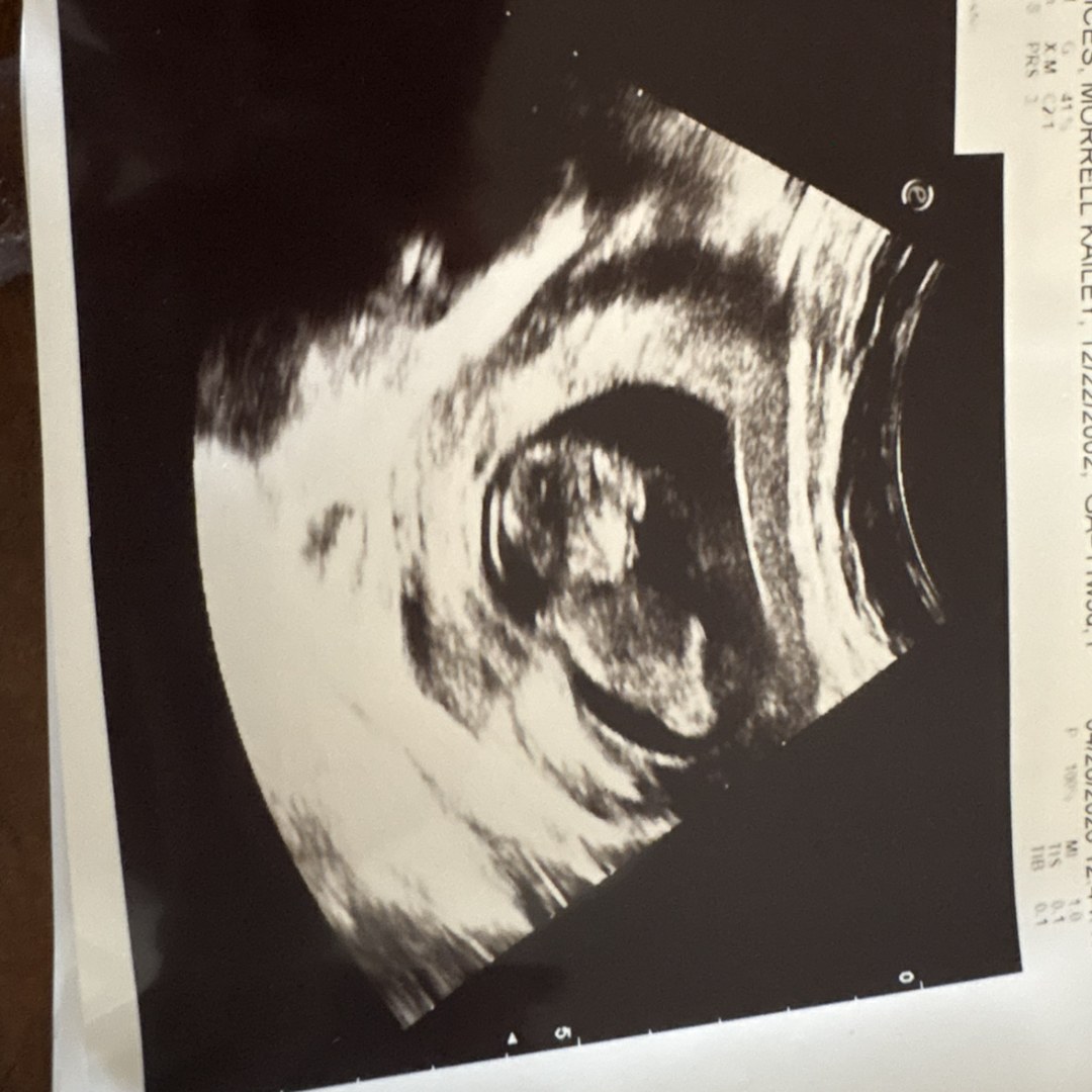 Photo shared by Kailey for their Babylist baby registry.