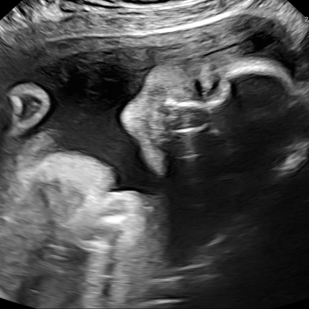 Photo shared by Bryanna for their Babylist baby registry.