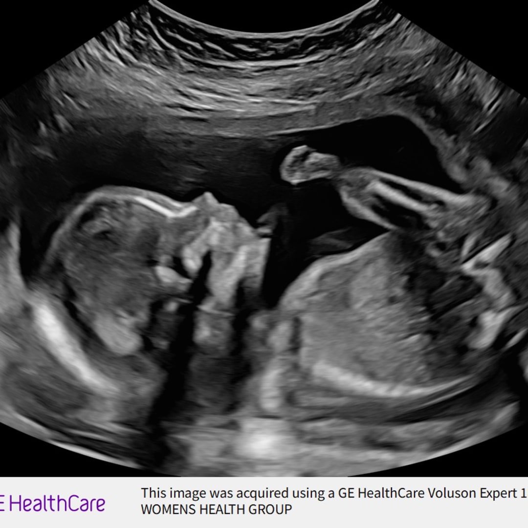 Photo shared by Xiomy for their Babylist baby registry.