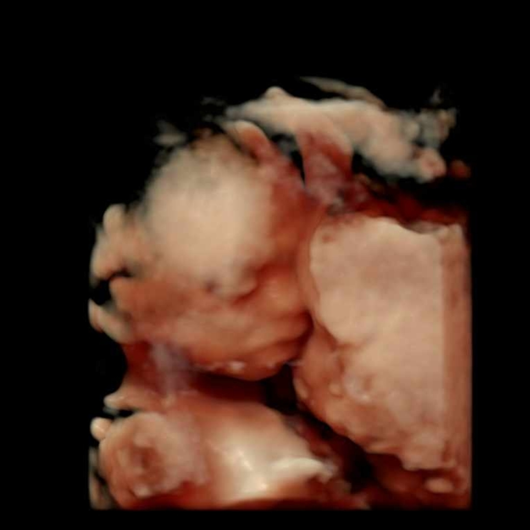 Photo shared by Amanda for their Babylist baby registry.