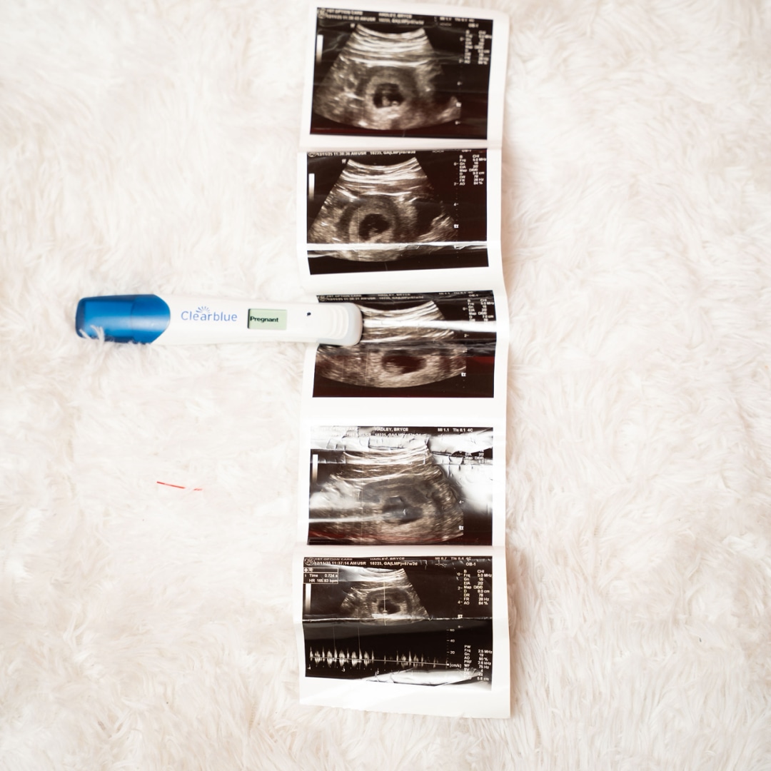 Photo shared by Bryce for their Babylist baby registry.