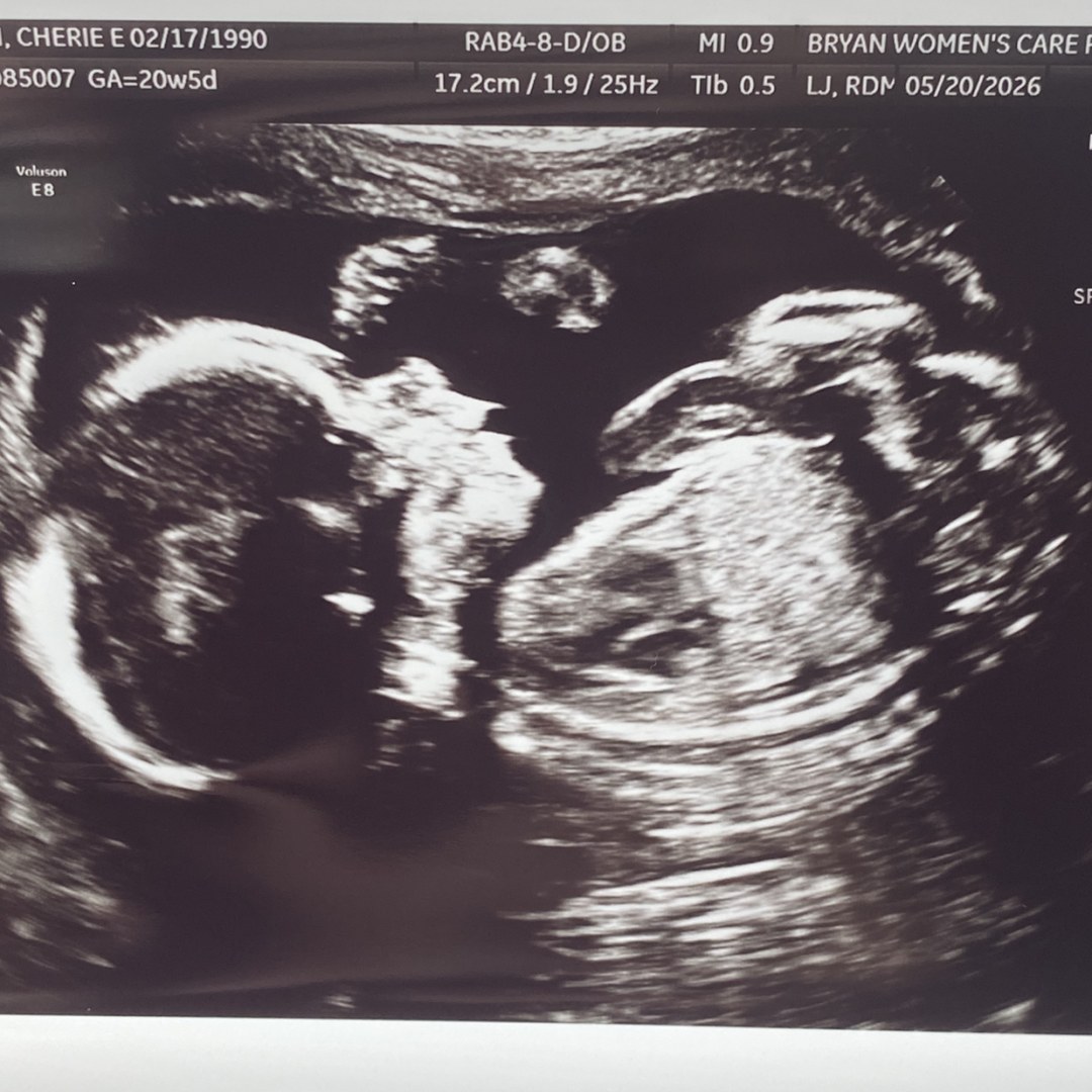 Photo shared by Cherie for their Babylist baby registry.