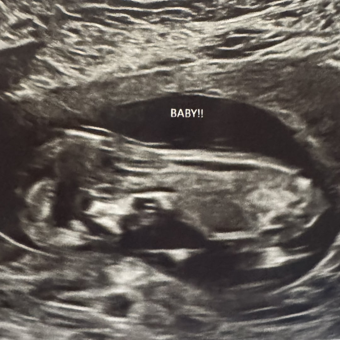 Photo shared by Grace for their Babylist baby registry.