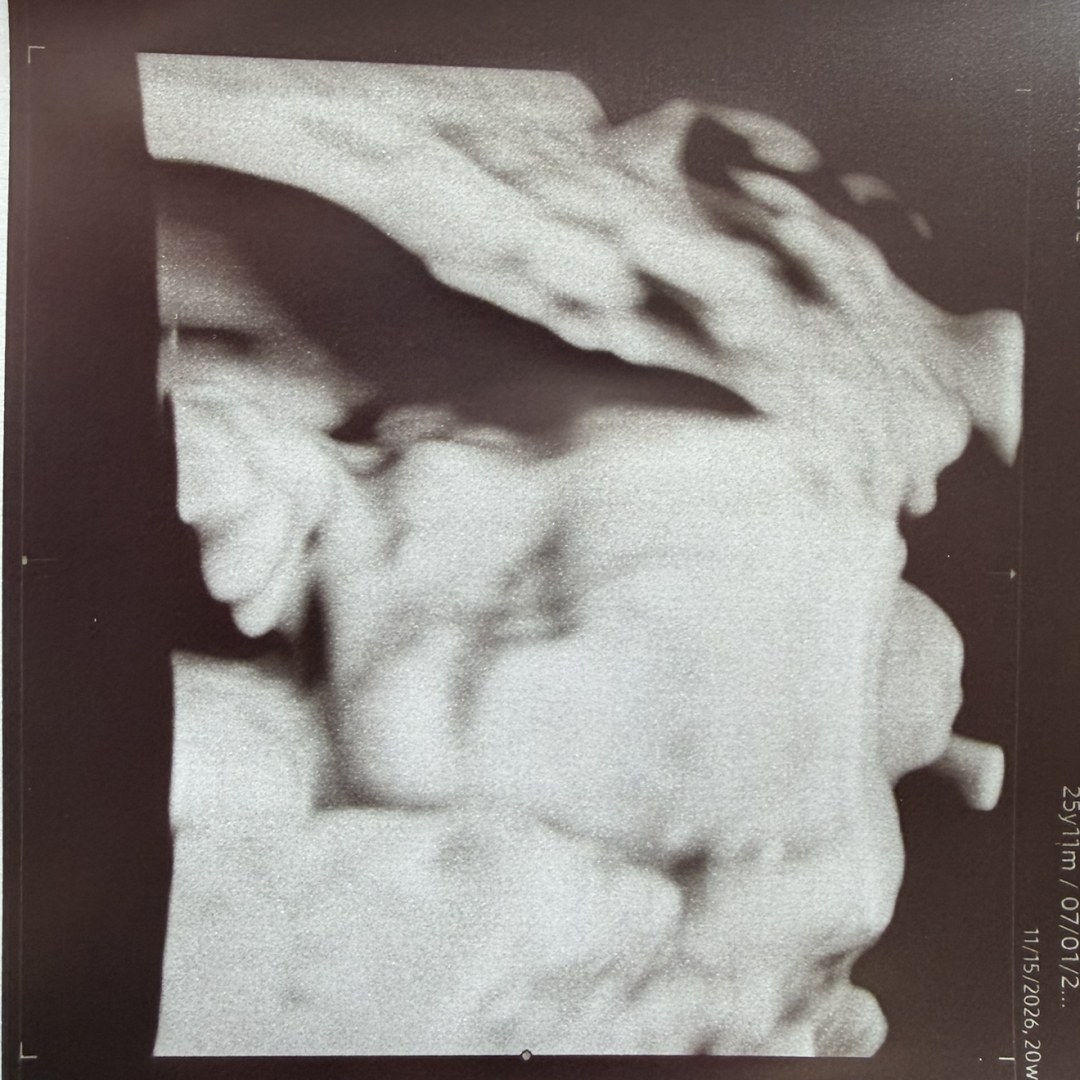 Photo shared by Carley for their Babylist baby registry.