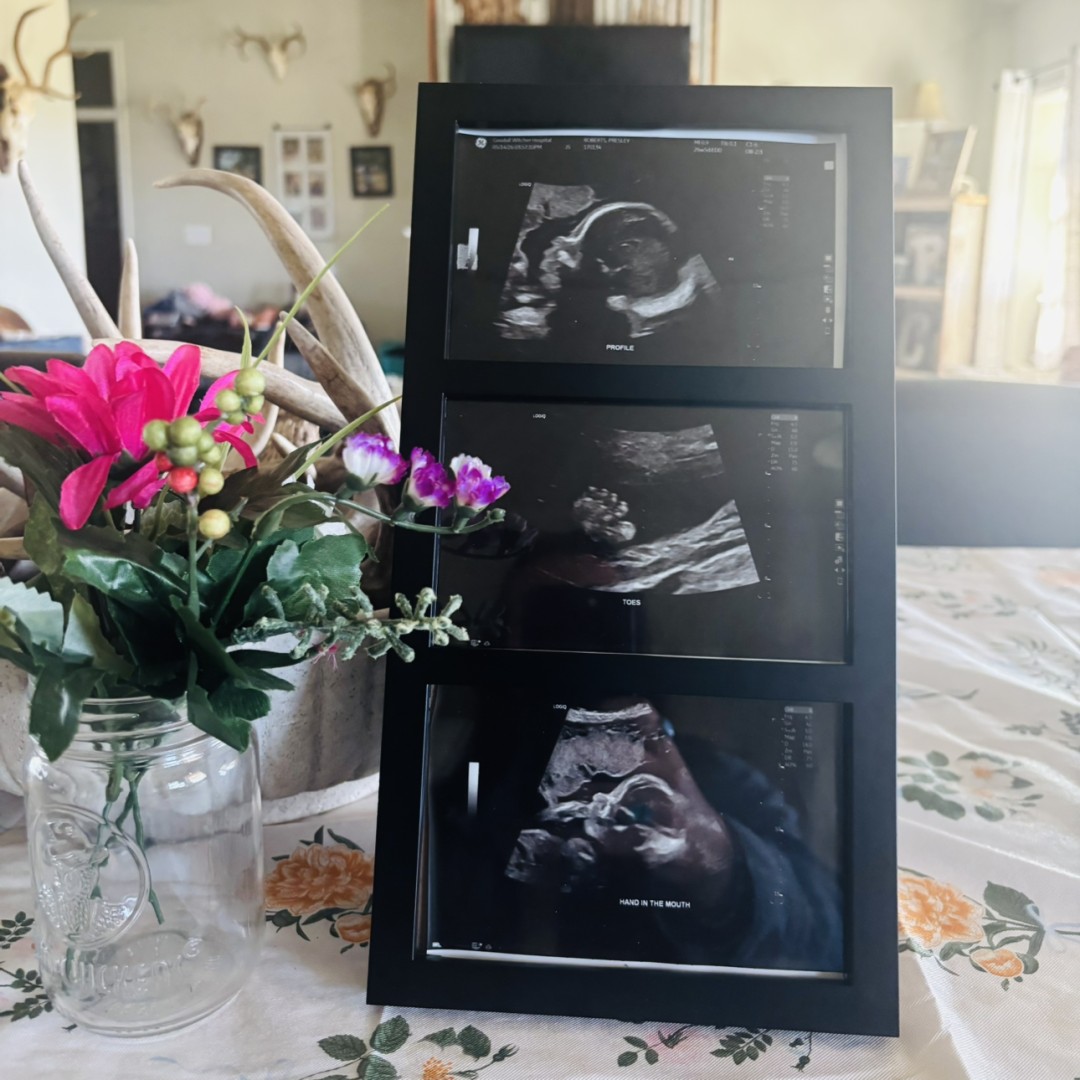 Photo shared by Presley for their Babylist baby registry.