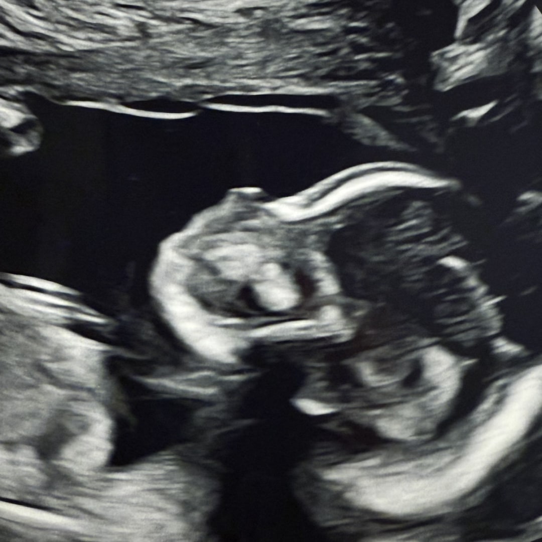 Photo shared by Jaimee for their Babylist baby registry.