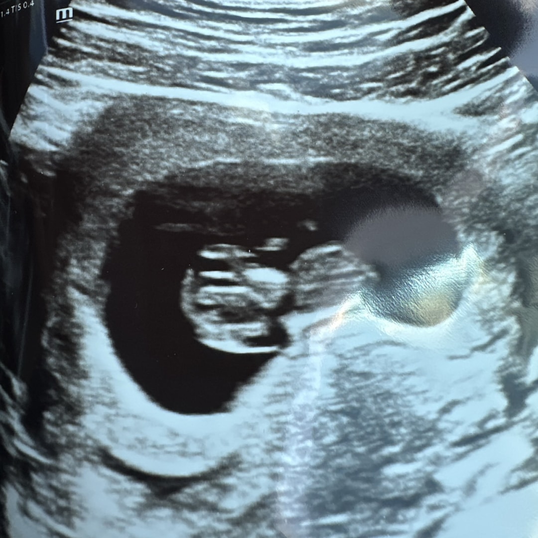 Photo shared by Ashley for their Babylist baby registry.