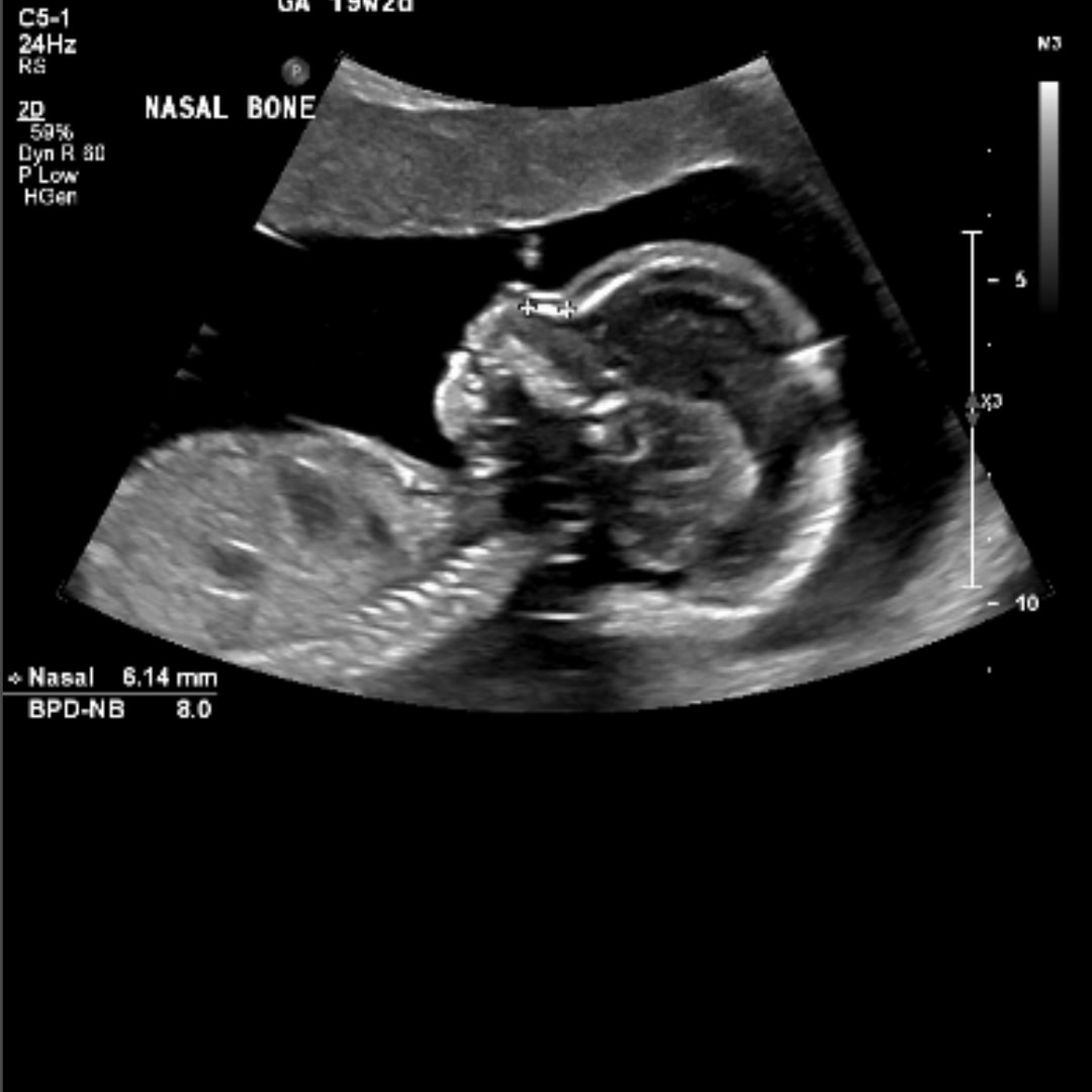 Photo shared by Katie for their Babylist baby registry.