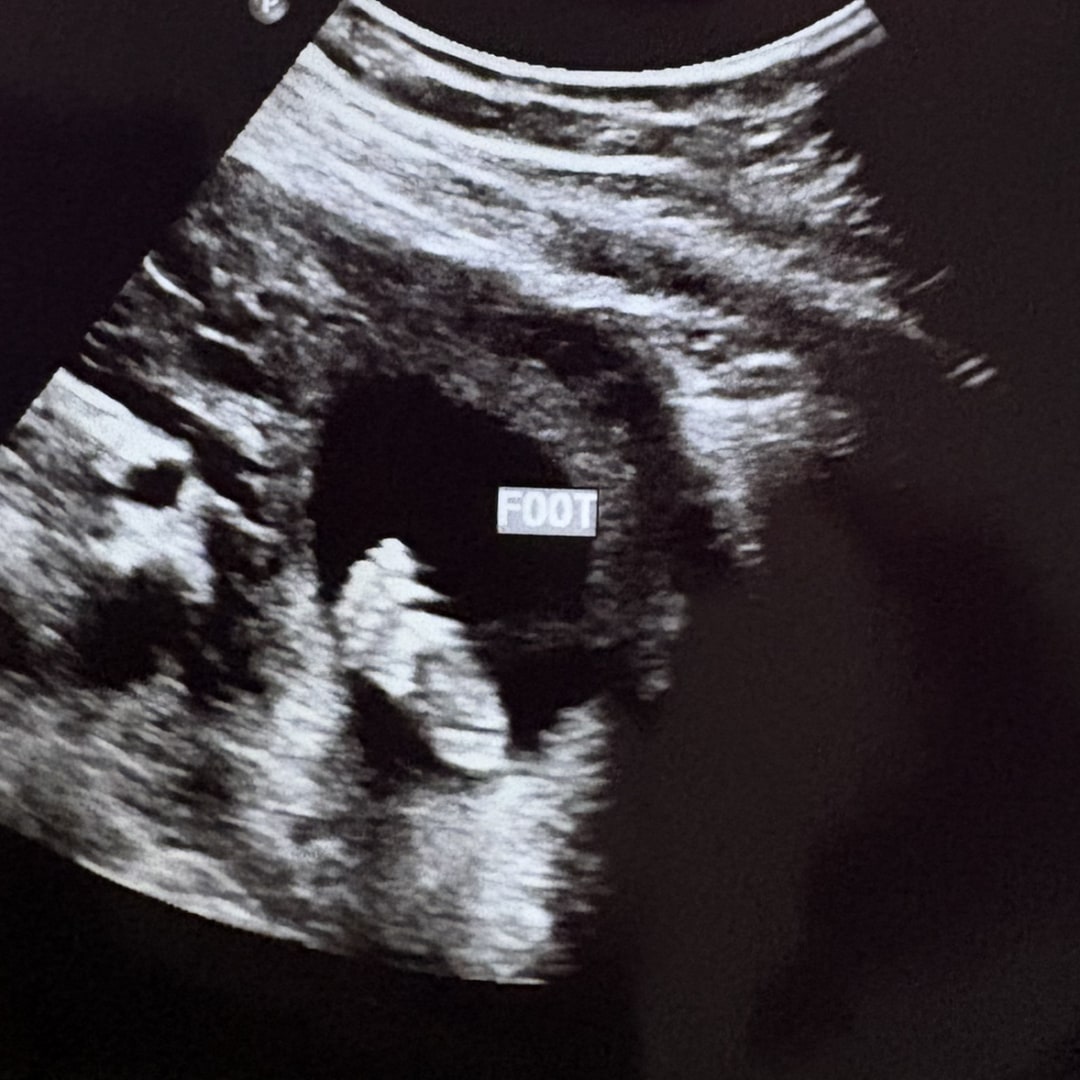 Photo shared by Alexis for their Babylist baby registry.