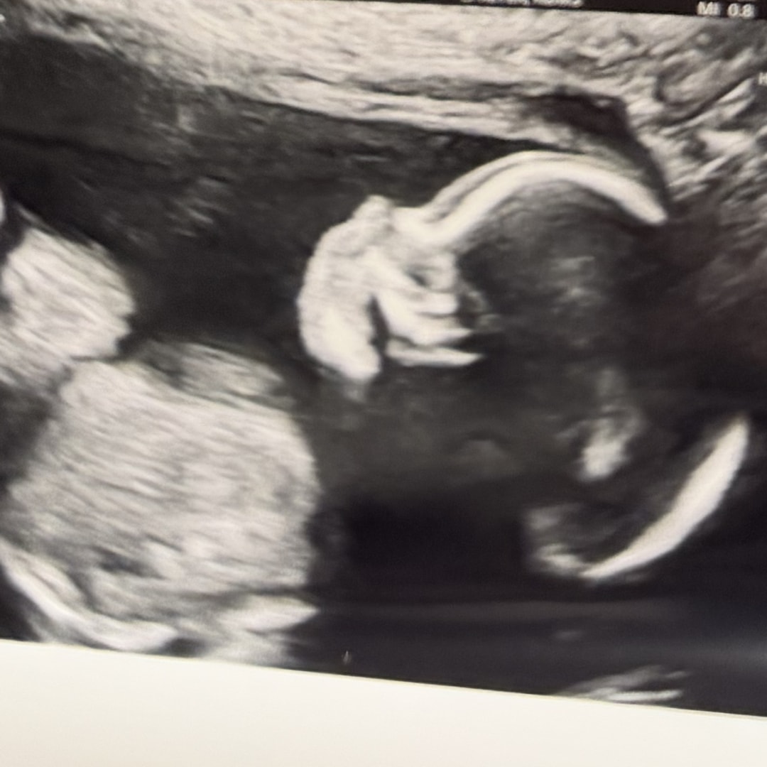 Photo shared by Shelby for their Babylist baby registry.