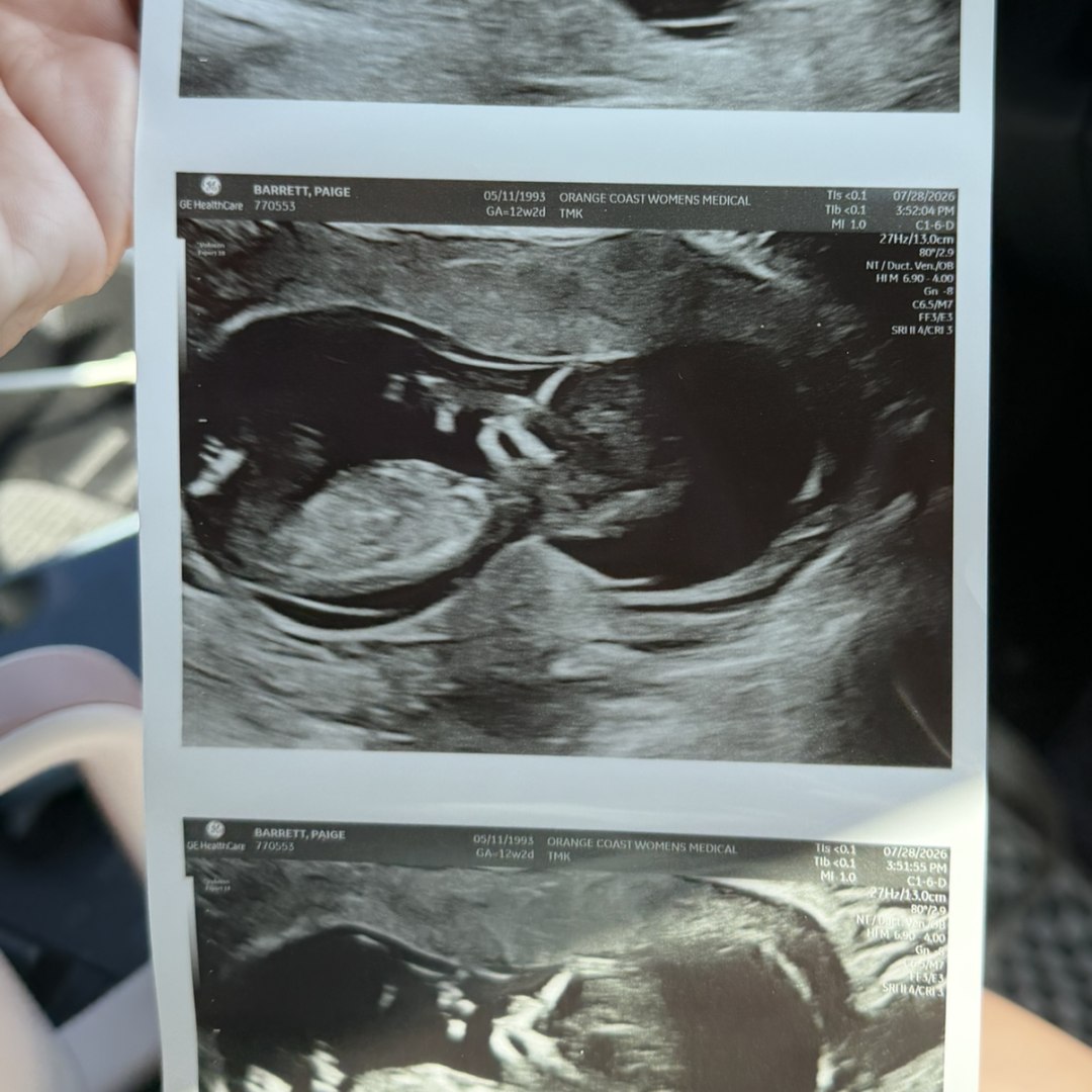 Photo shared by Paige for their Babylist baby registry.