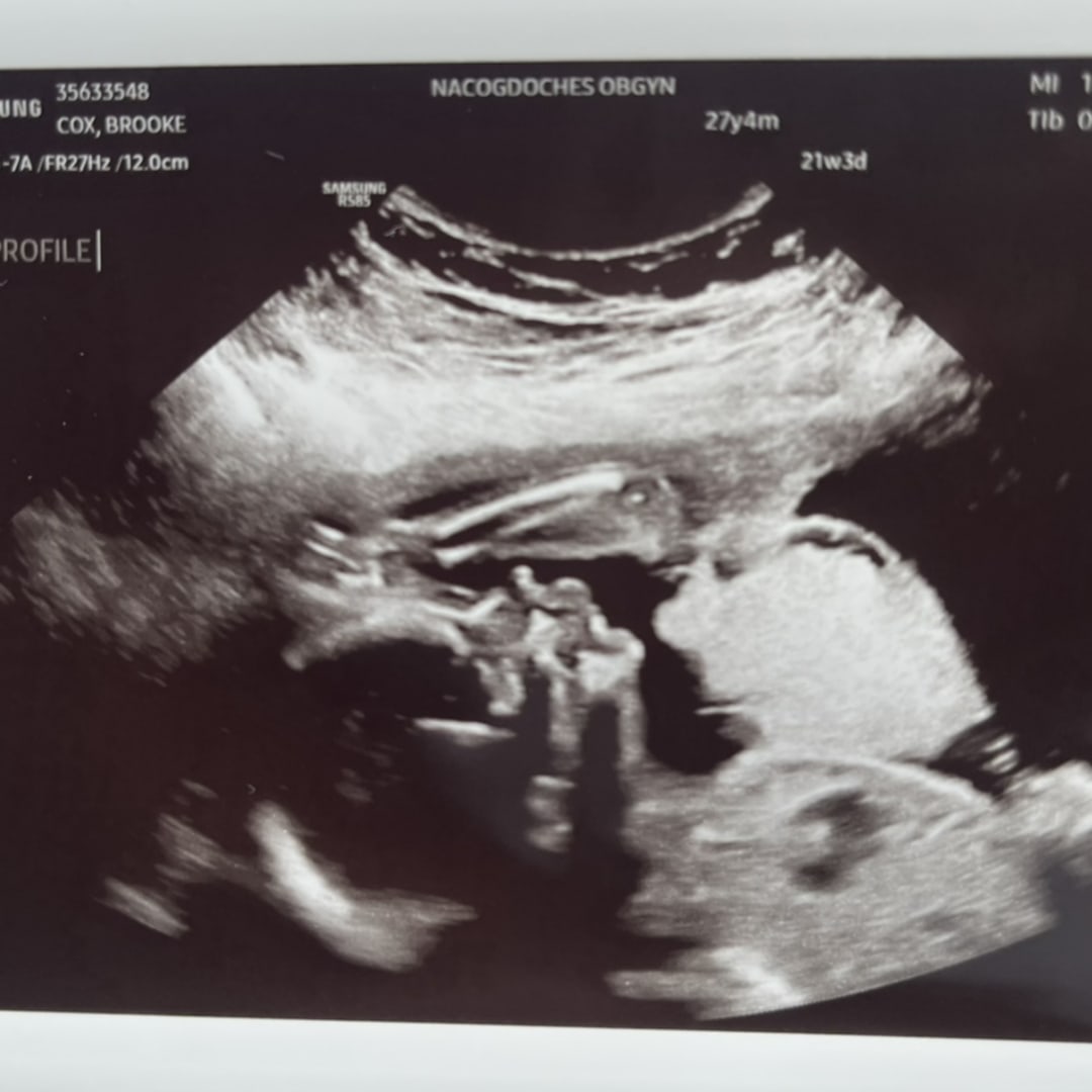 Photo shared by Brooke for their Babylist baby registry.