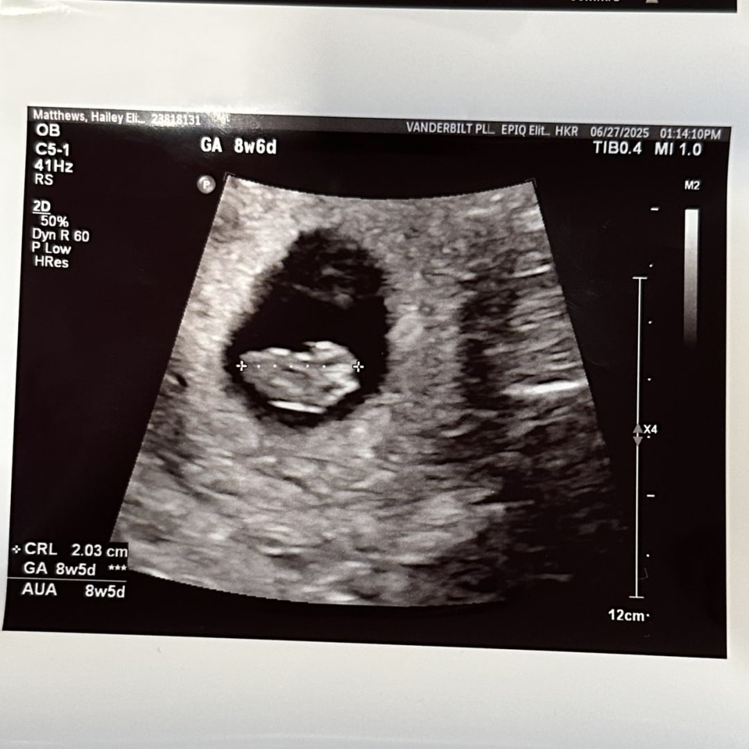 Photo shared by Hailey for their Babylist baby registry.