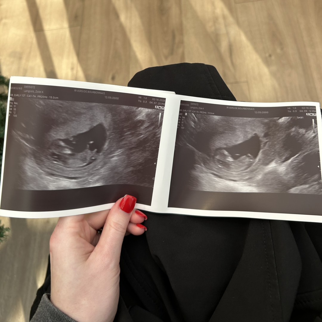 Photo shared by Zoie for their Babylist baby registry.