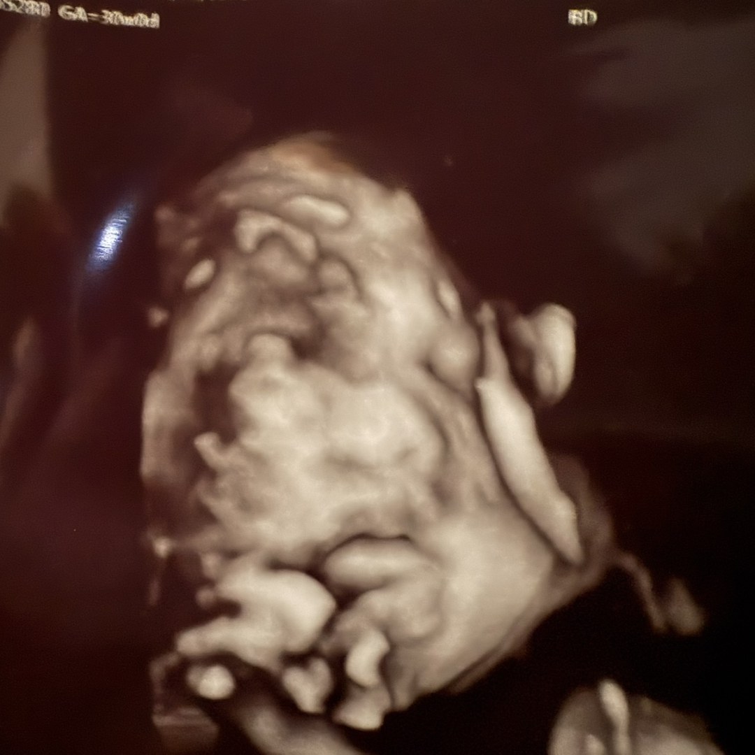 Photo shared by Silvia for their Babylist baby registry.