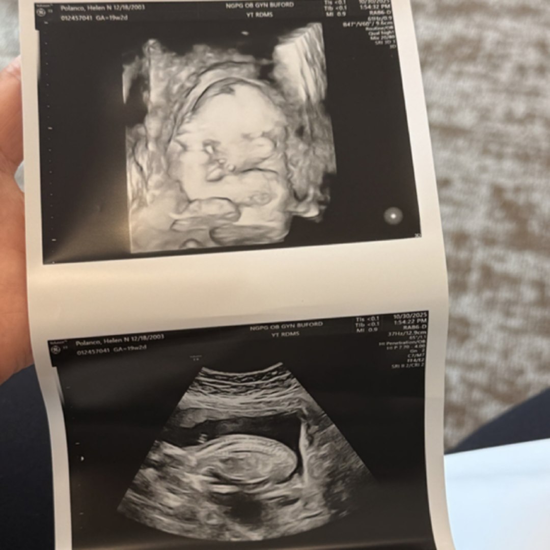 Photo shared by Helen for their Babylist baby registry.