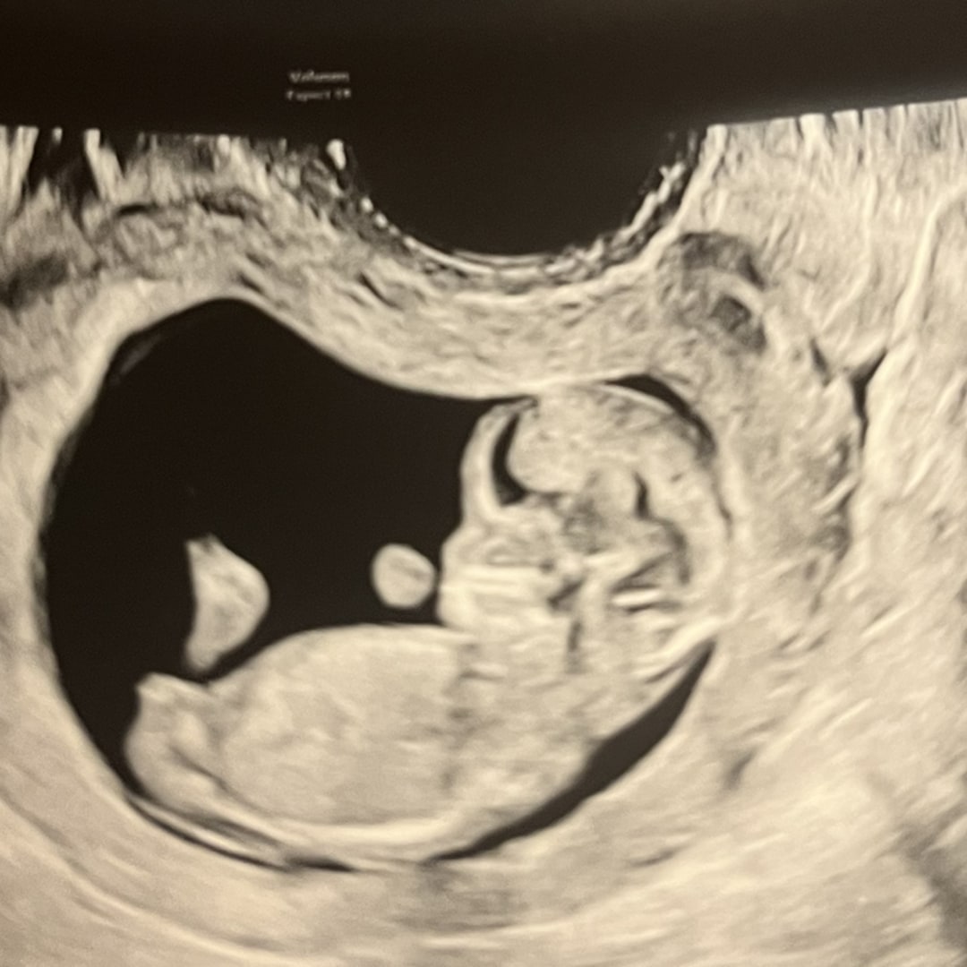 Photo shared by Julia for their Babylist baby registry.