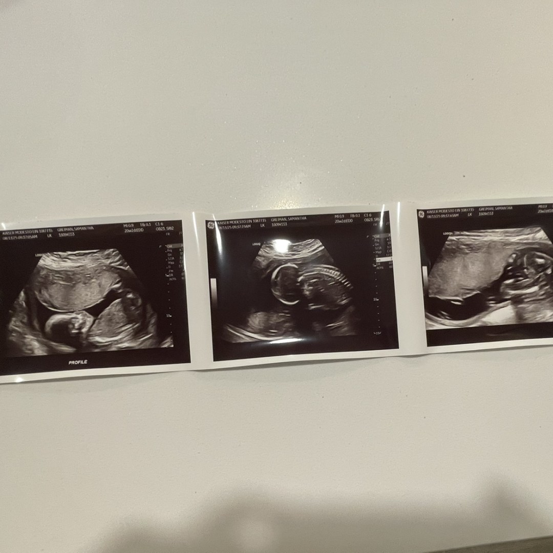 Photo shared by Samantha for their Babylist baby registry.