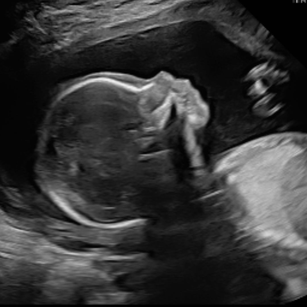 Photo shared by Samantha for their Babylist baby registry.