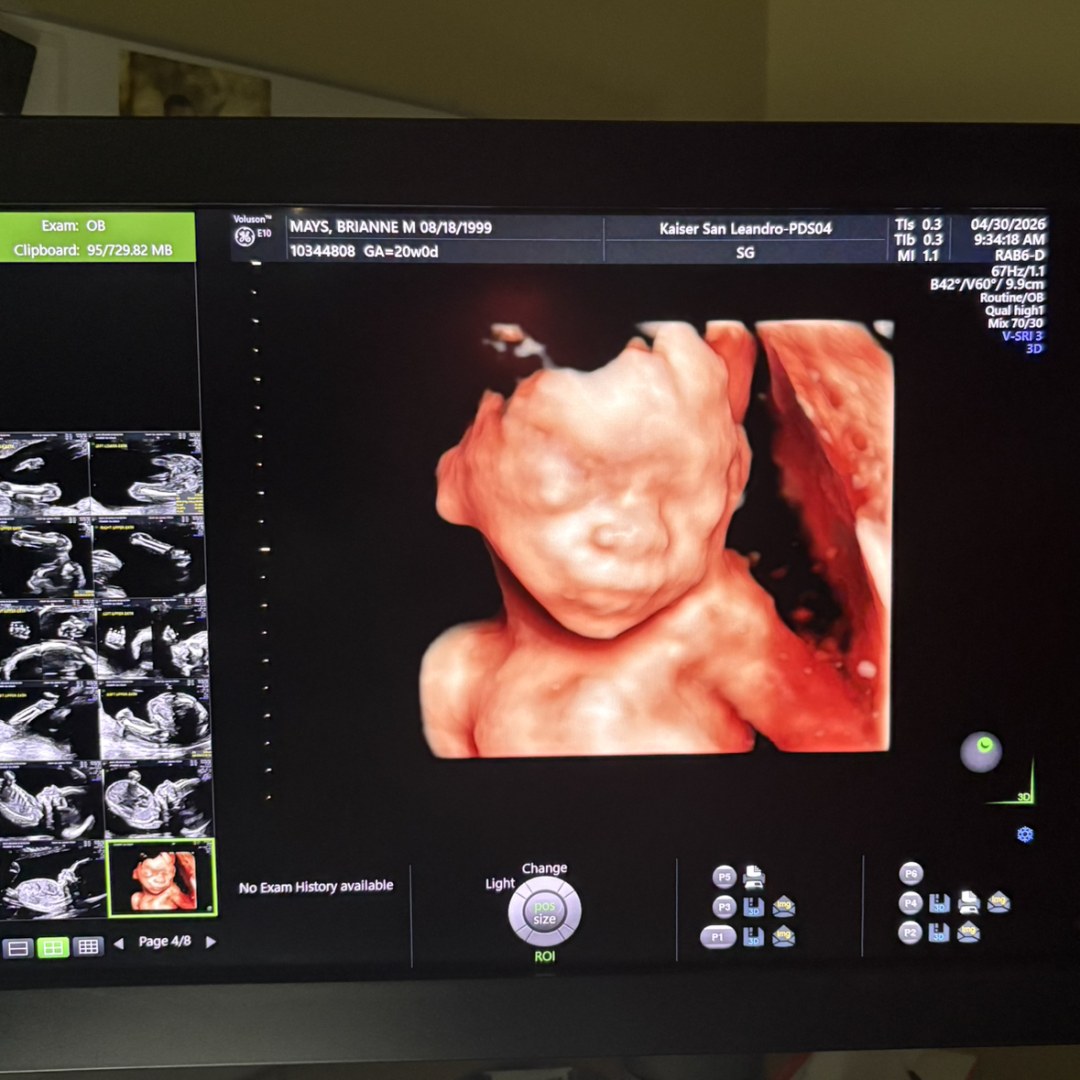Photo shared by Brianne for their Babylist baby registry.