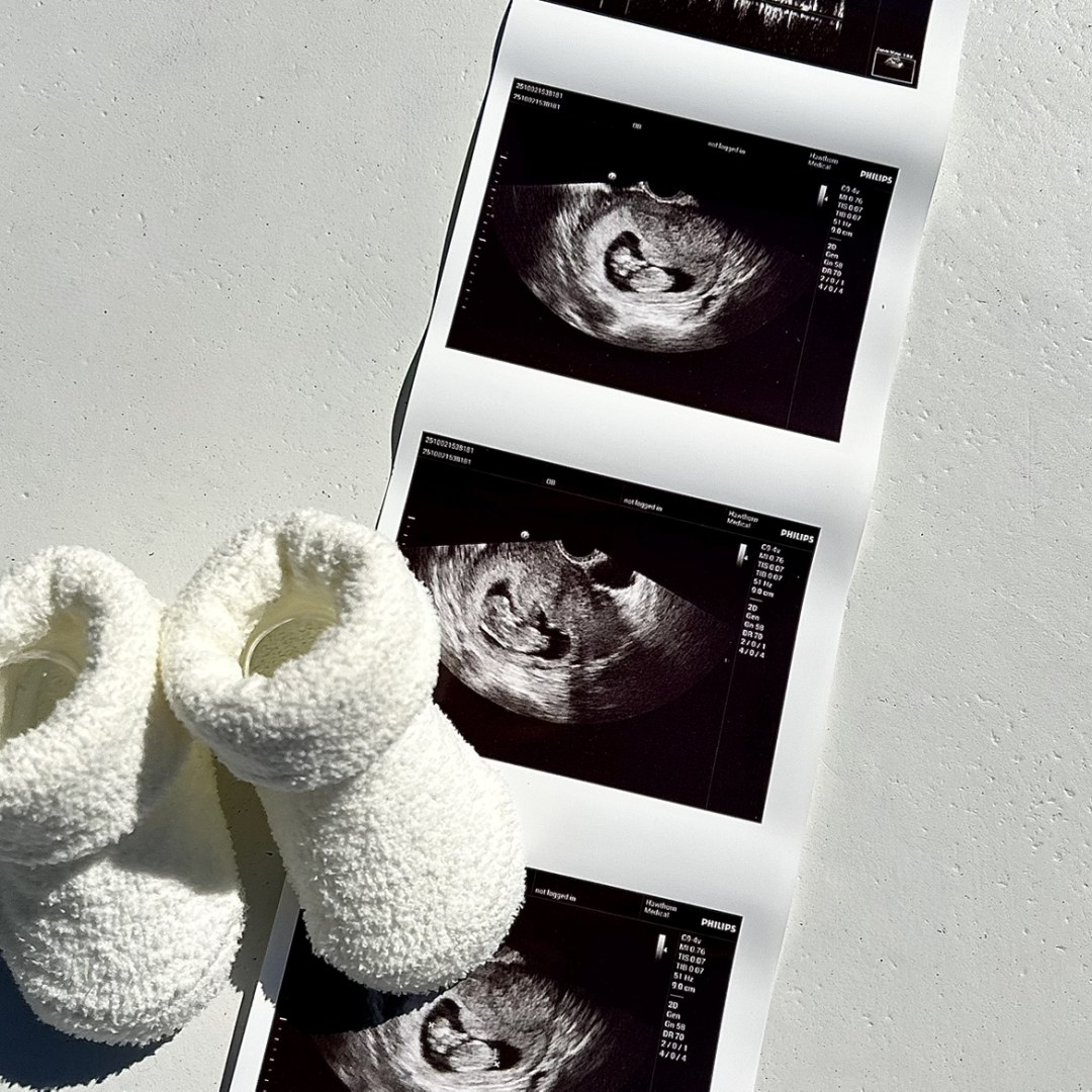 Photo shared by Sophie for their Babylist baby registry.