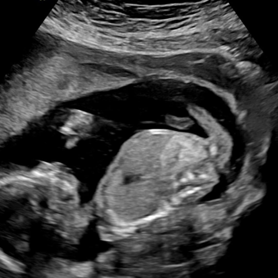 Photo shared by Sara for their Babylist baby registry.