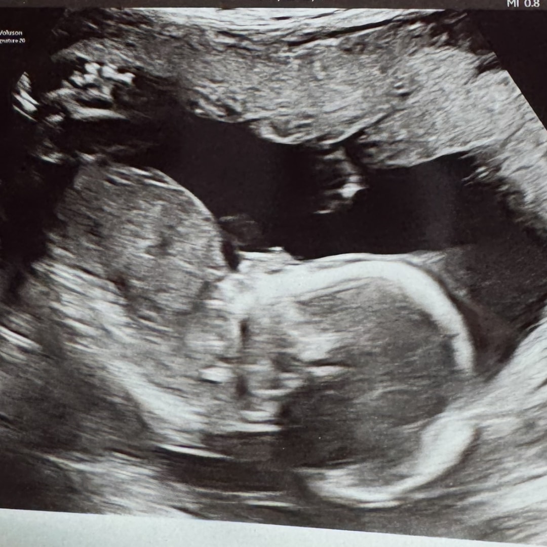 Photo shared by Vera for their Babylist baby registry.