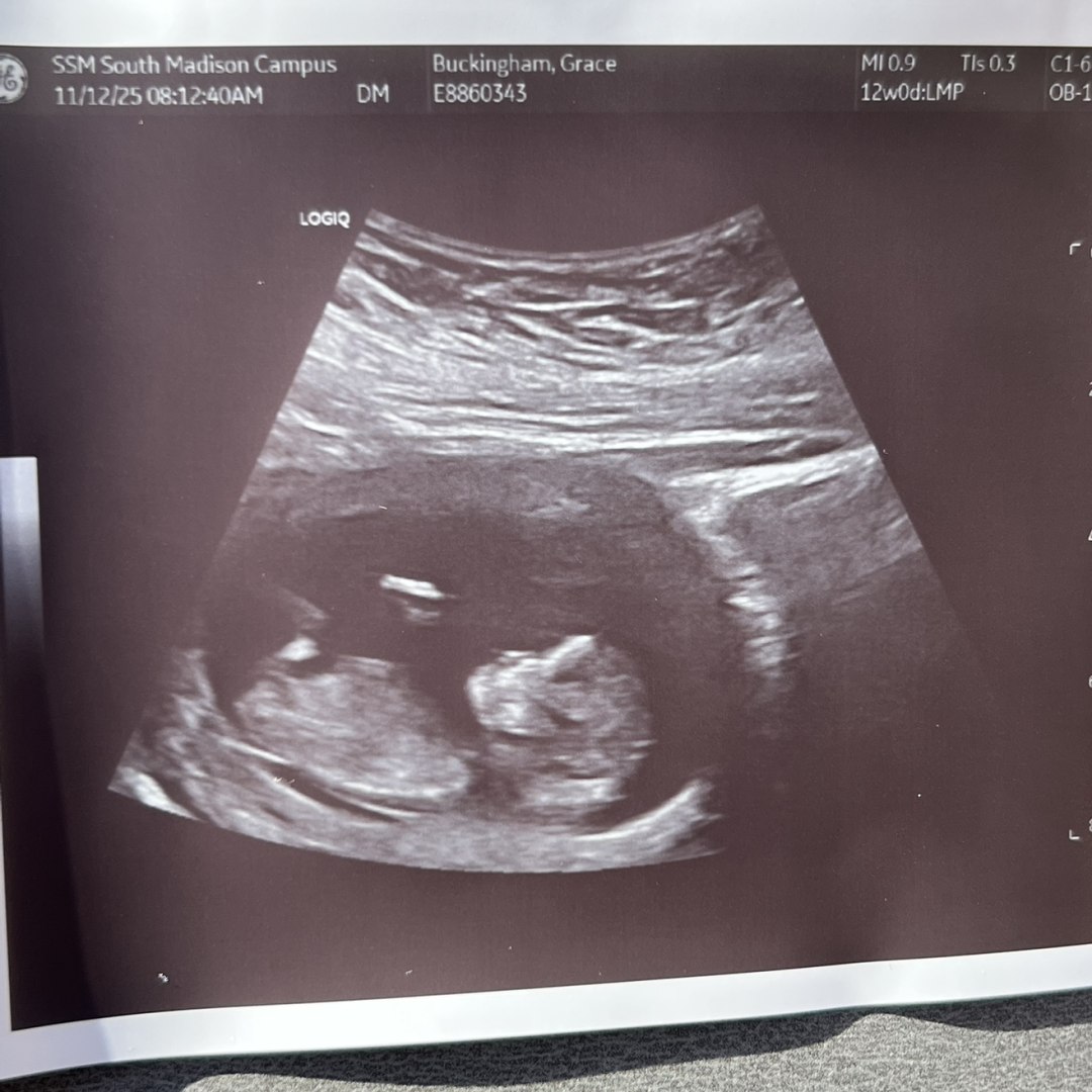 Photo shared by Gracie for their Babylist baby registry.