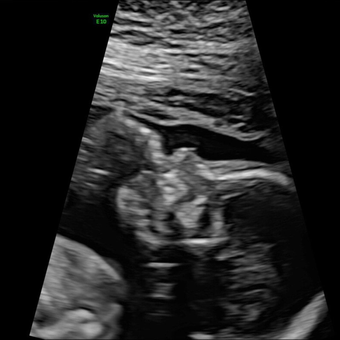 Photo shared by Dani for their Babylist baby registry.