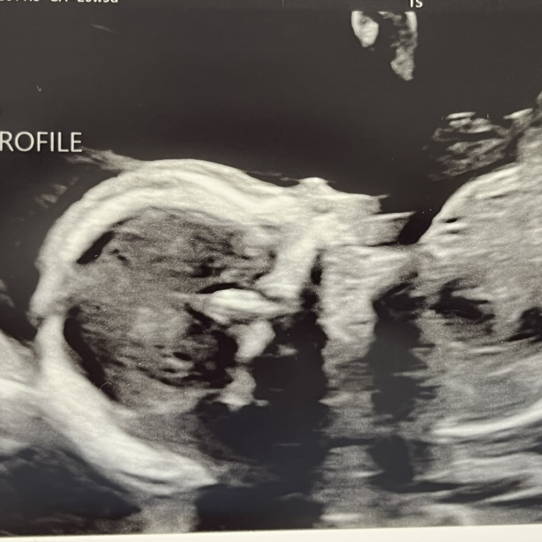 Photo shared by Emily for their Babylist baby registry.