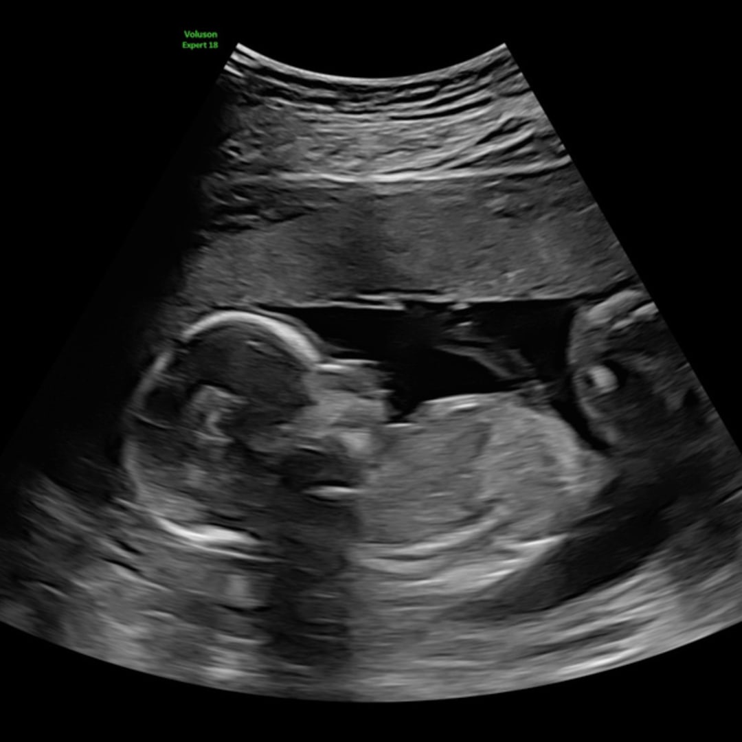 Photo shared by Rebecca for their Babylist baby registry.
