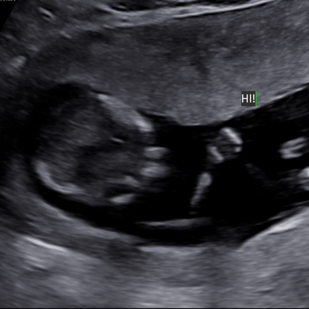 Photo shared by Adrianna for their Babylist baby registry.
