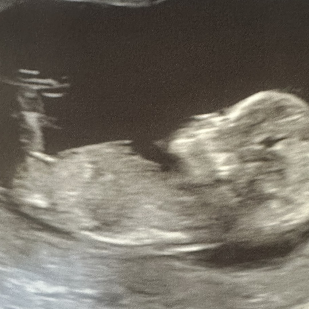 Photo shared by Hanna for their Babylist baby registry.