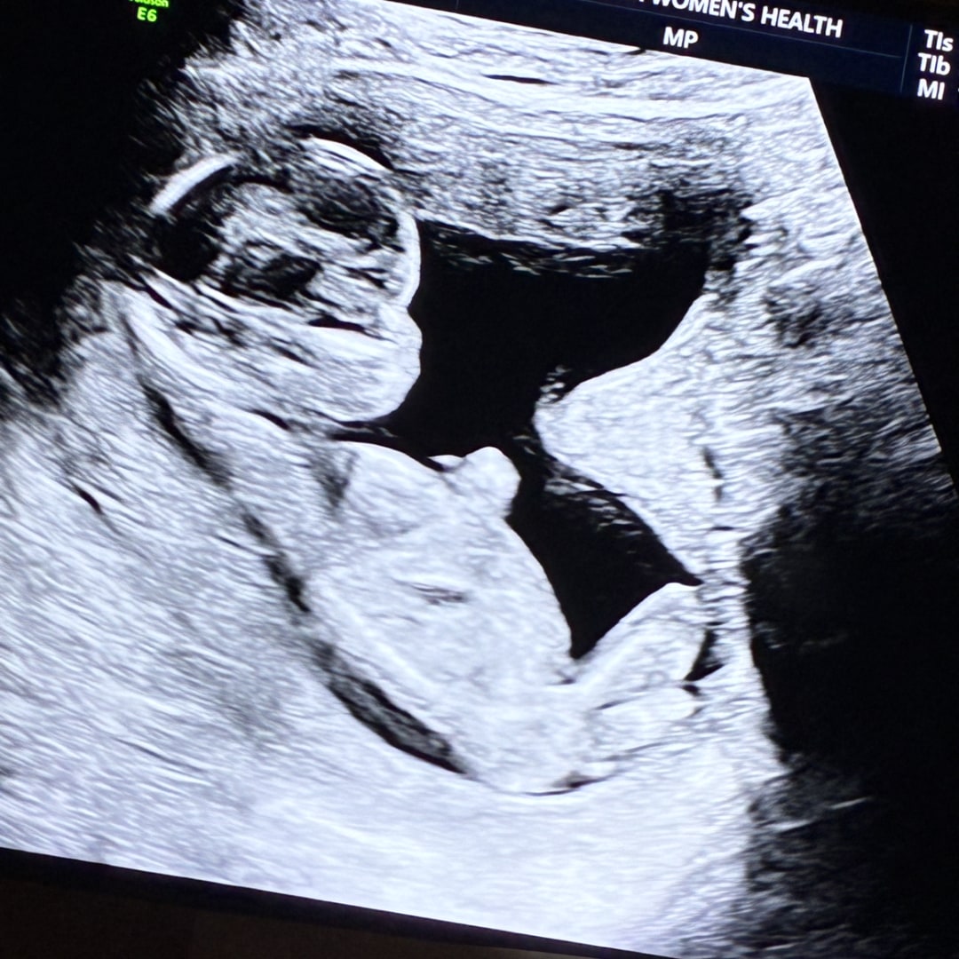 Photo shared by Sakira for their Babylist baby registry.