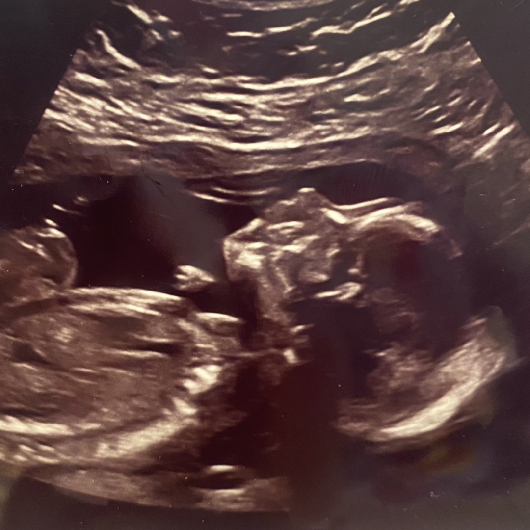 Photo shared by Heather for their Babylist baby registry.