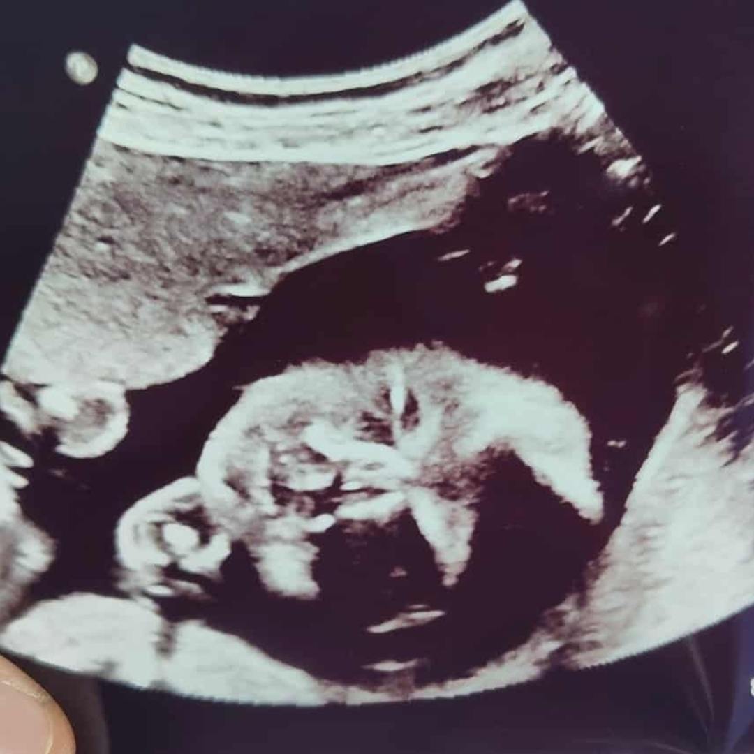 Photo shared by Cheyenne for their Babylist baby registry.