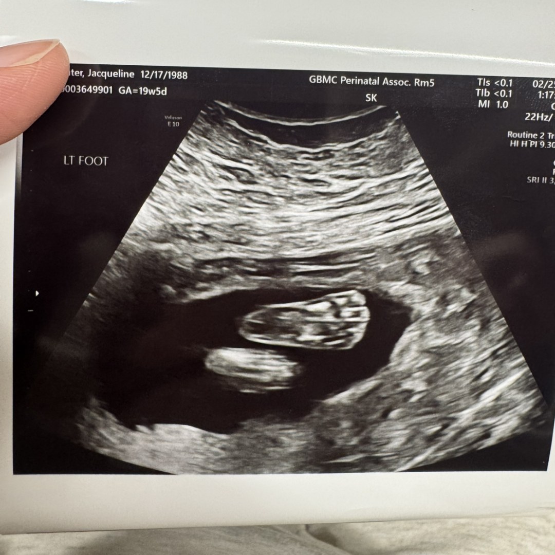 Photo shared by Jacqueline for their Babylist baby registry.