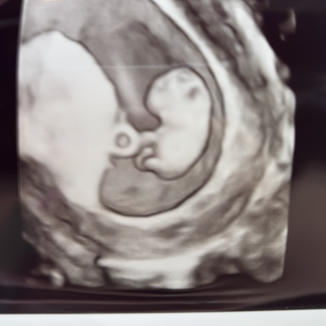 Photo shared by Kassidy for their Babylist baby registry.