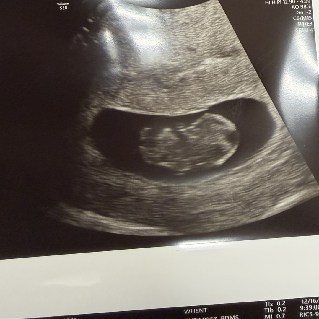 Photo shared by Natalie for their Babylist baby registry.