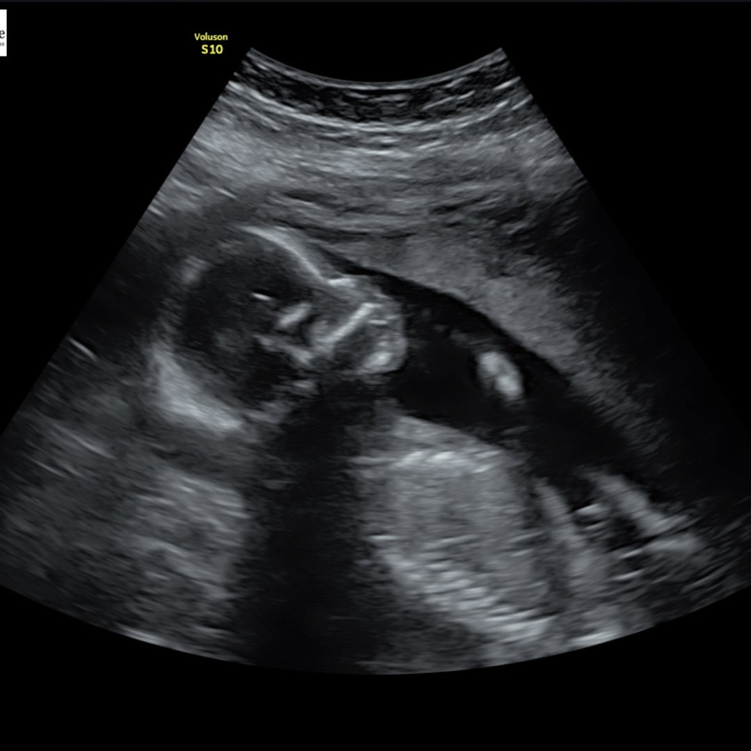 Photo shared by Tiara for their Babylist baby registry.
