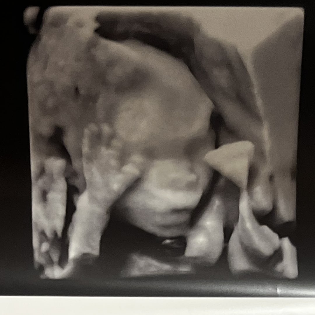 Photo shared by Haley for their Babylist baby registry.