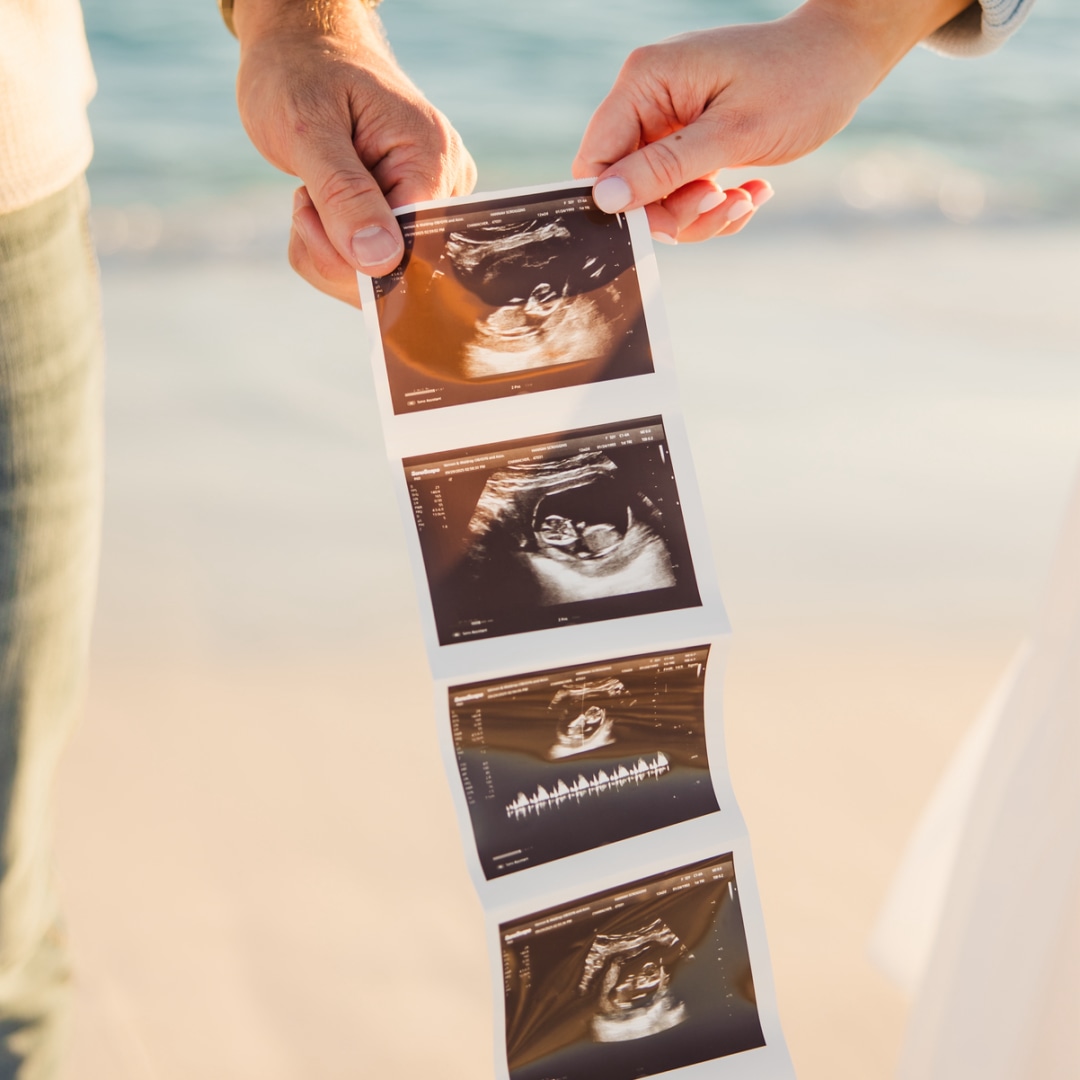 Photo shared by Hannah for their Babylist baby registry.